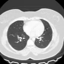 Tomografia de tórax, corte axial (janela de pulmão)