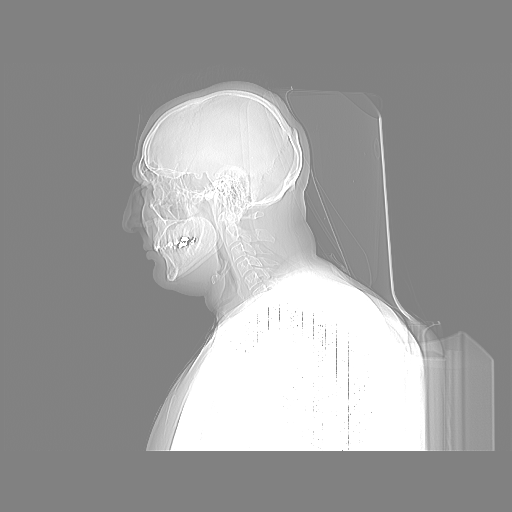 Head x-ray